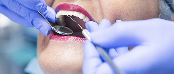 Best Emergency Denture Repair in Sherwood, OR